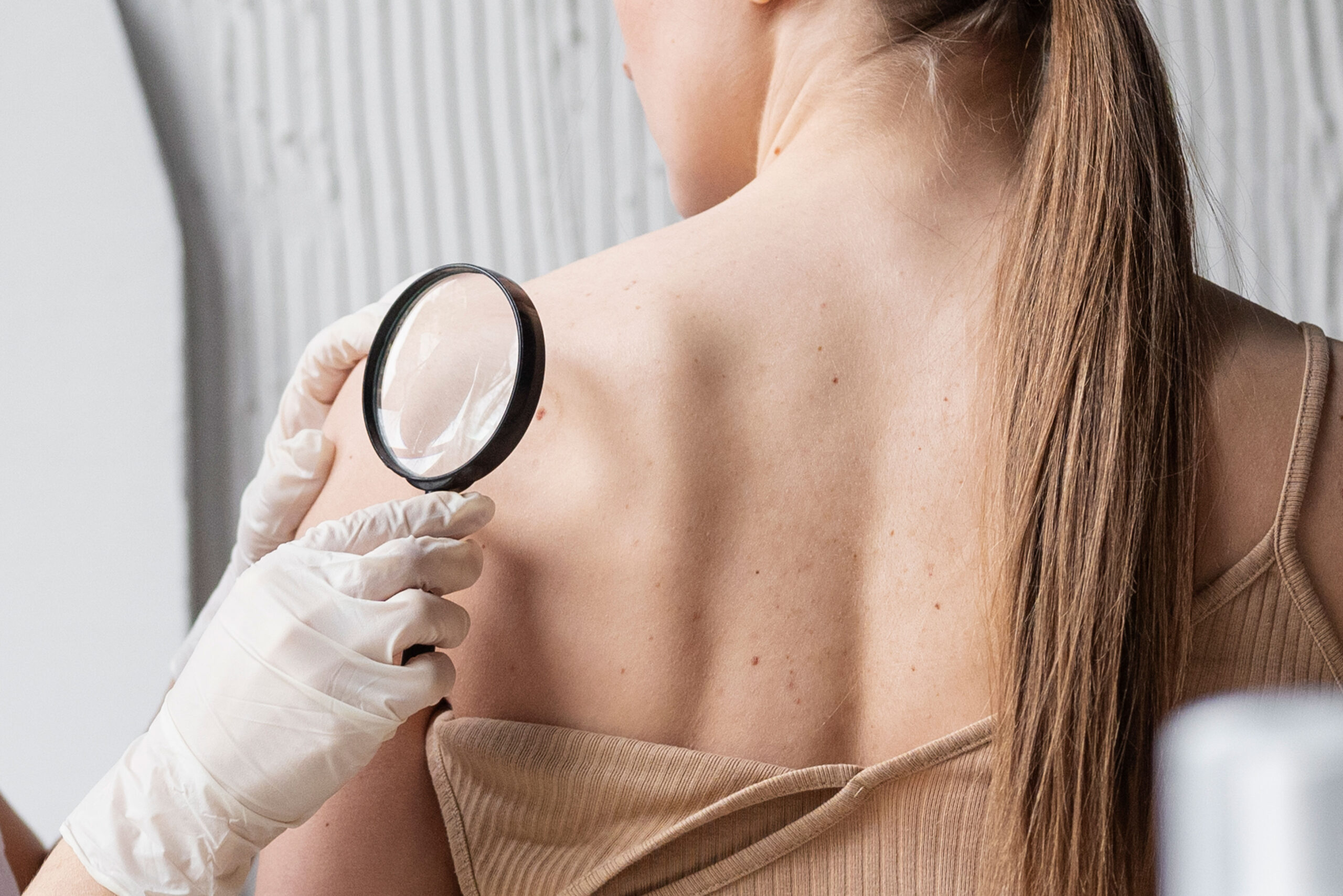 Consulta Dermatológica: Muito Além da Estética
