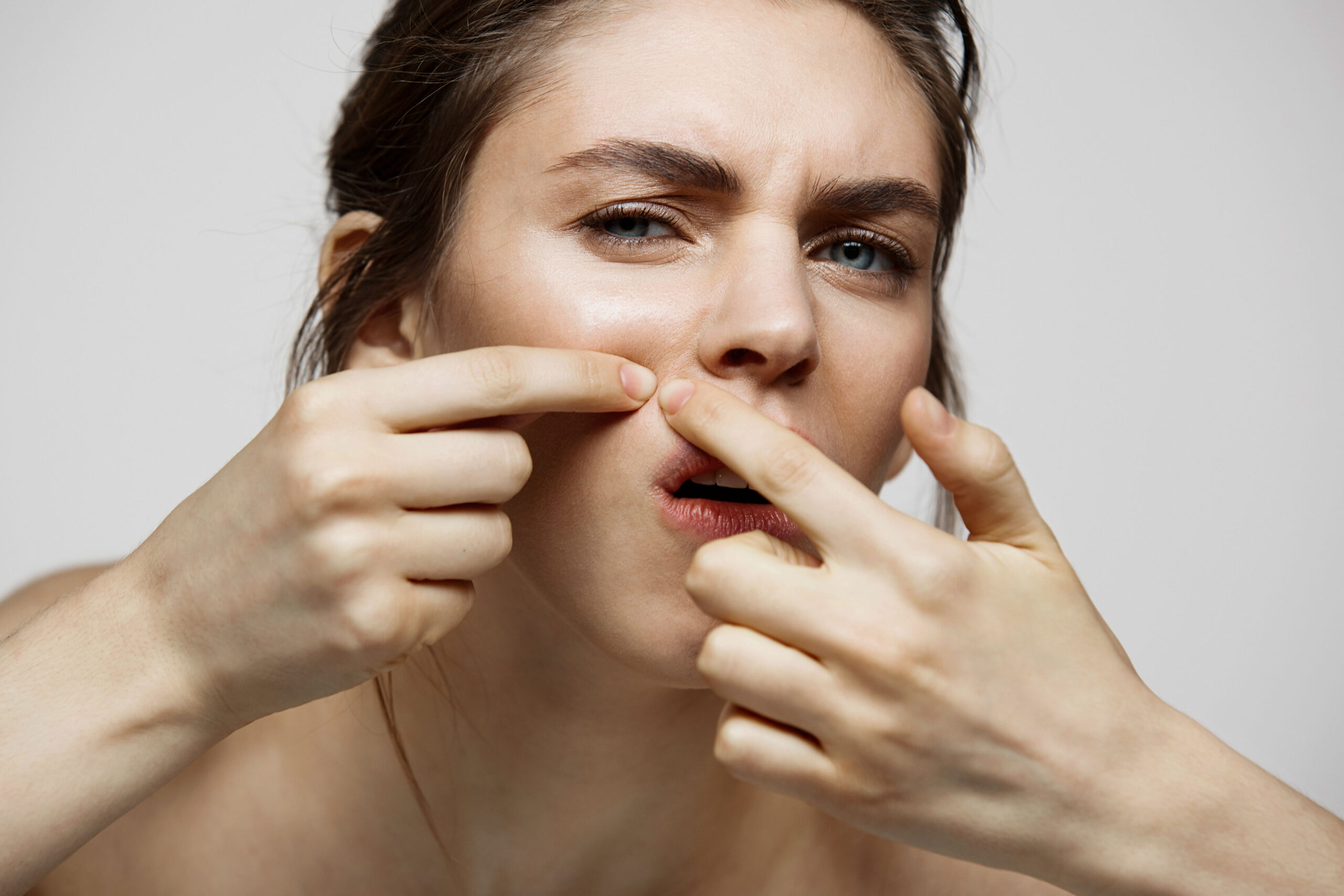 Espinha Interna – Entenda e Evite Marcas na Pele