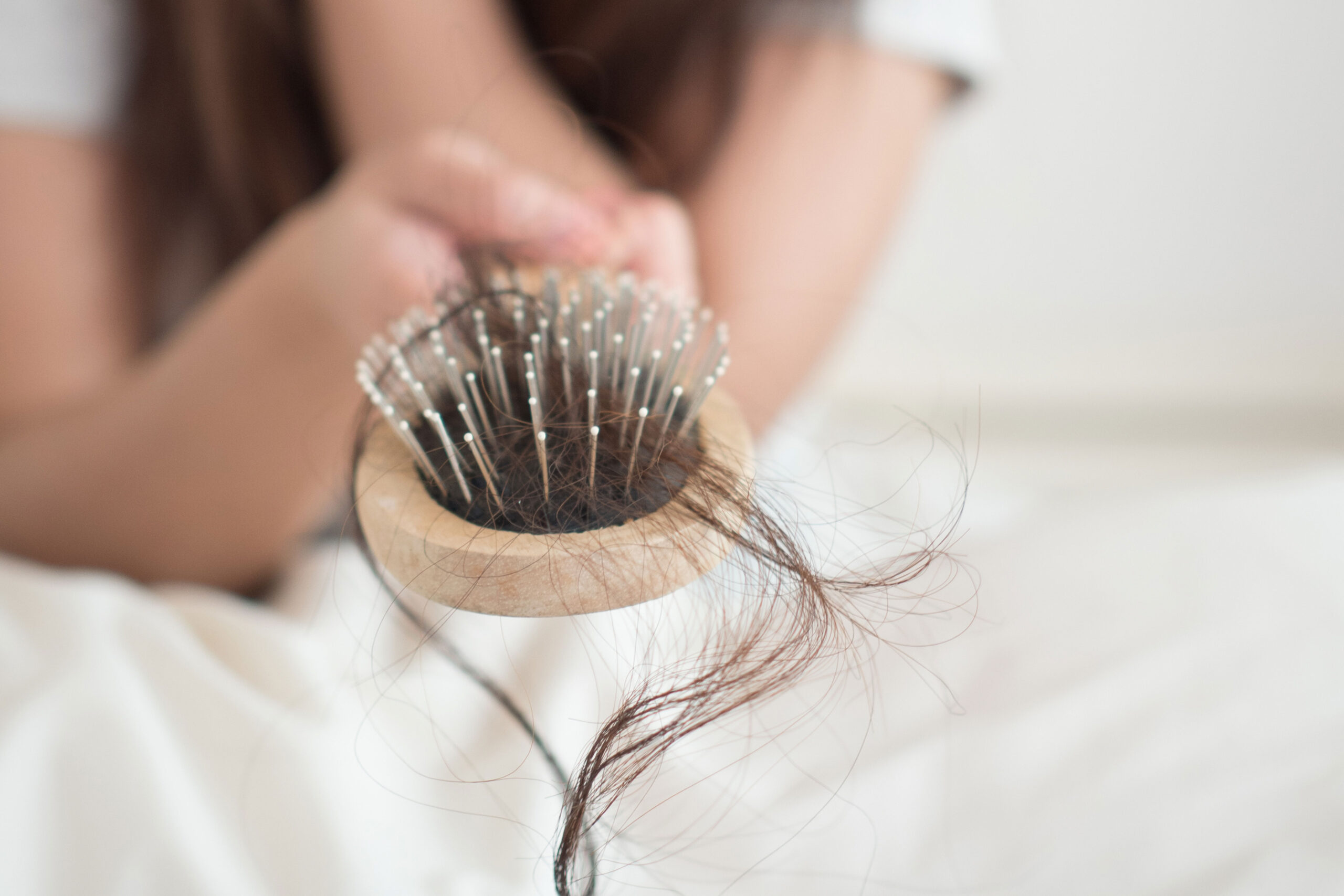 Queda de cabelo após emagrecimento: causas e quando investigar