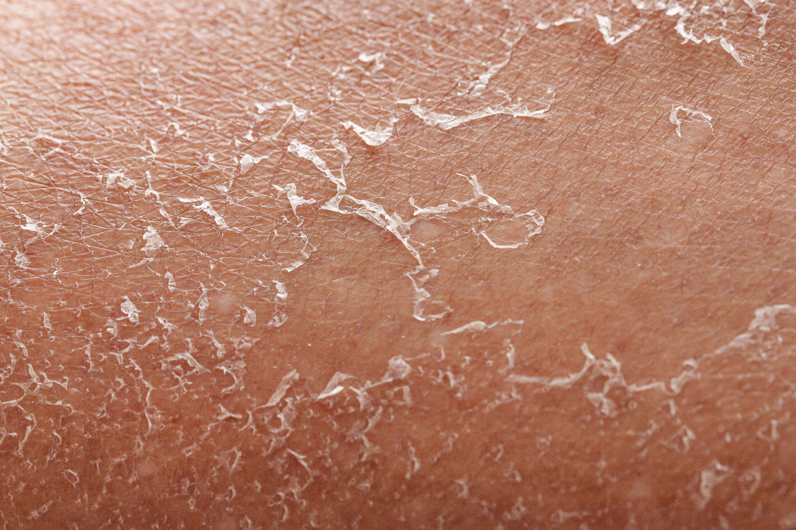 Pele Desidratada ou Seca: Entenda a Diferença